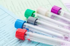 Folate Metabolism Test for MTHFR